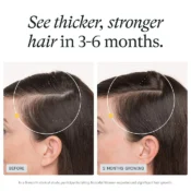 Before and after 3 months